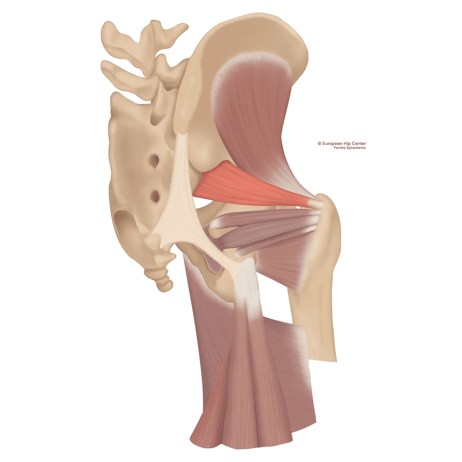 Anatomische illustratie van de piriformis spier en de bilzenuw bij diep gluteaal syndroom